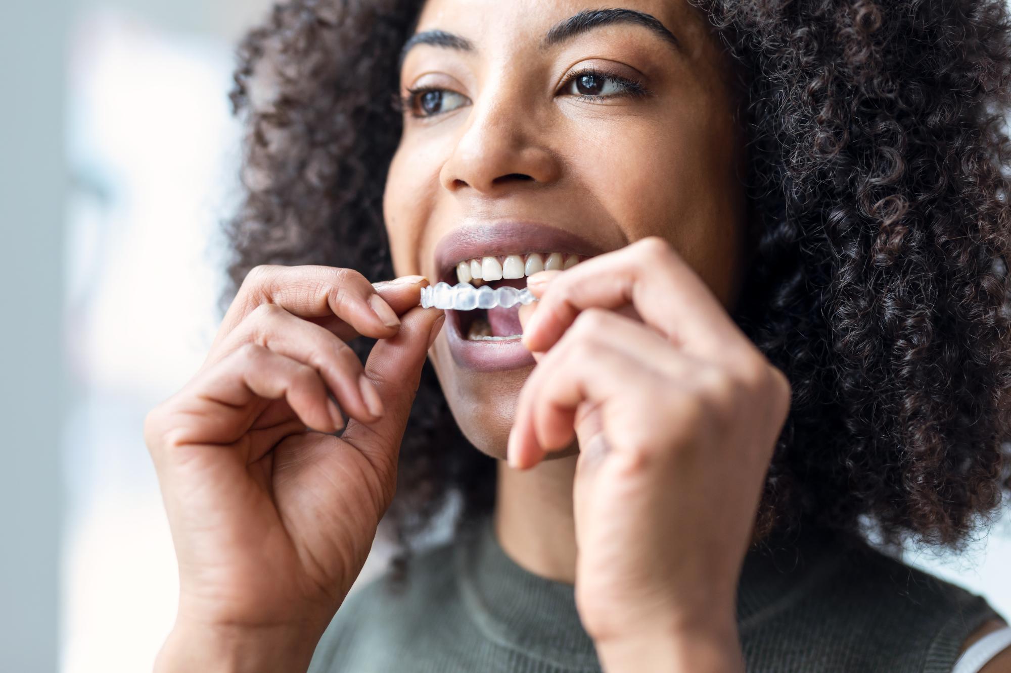 Retainers